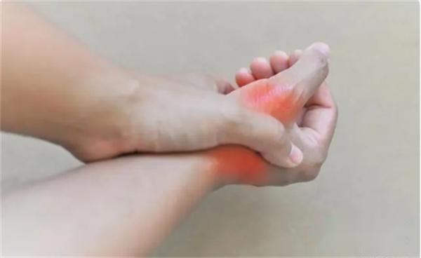 “嘌呤大户”被揪出 你认为的美味佳肴 或会升高尿酸 别太贪嘴