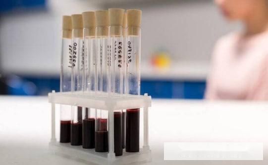 验什么血可以看胃病