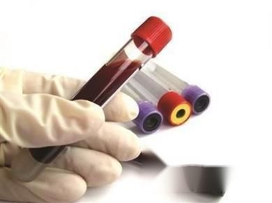 身体上出现4个信号，就说明你的血液黏稠！